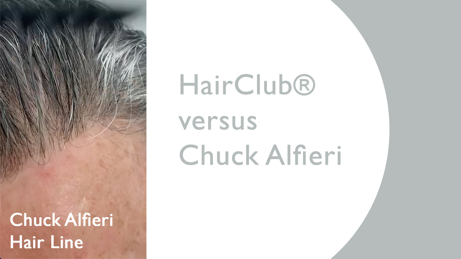 HairClub® for Men Versus Chuck Alfieri | Chuck Alfieri