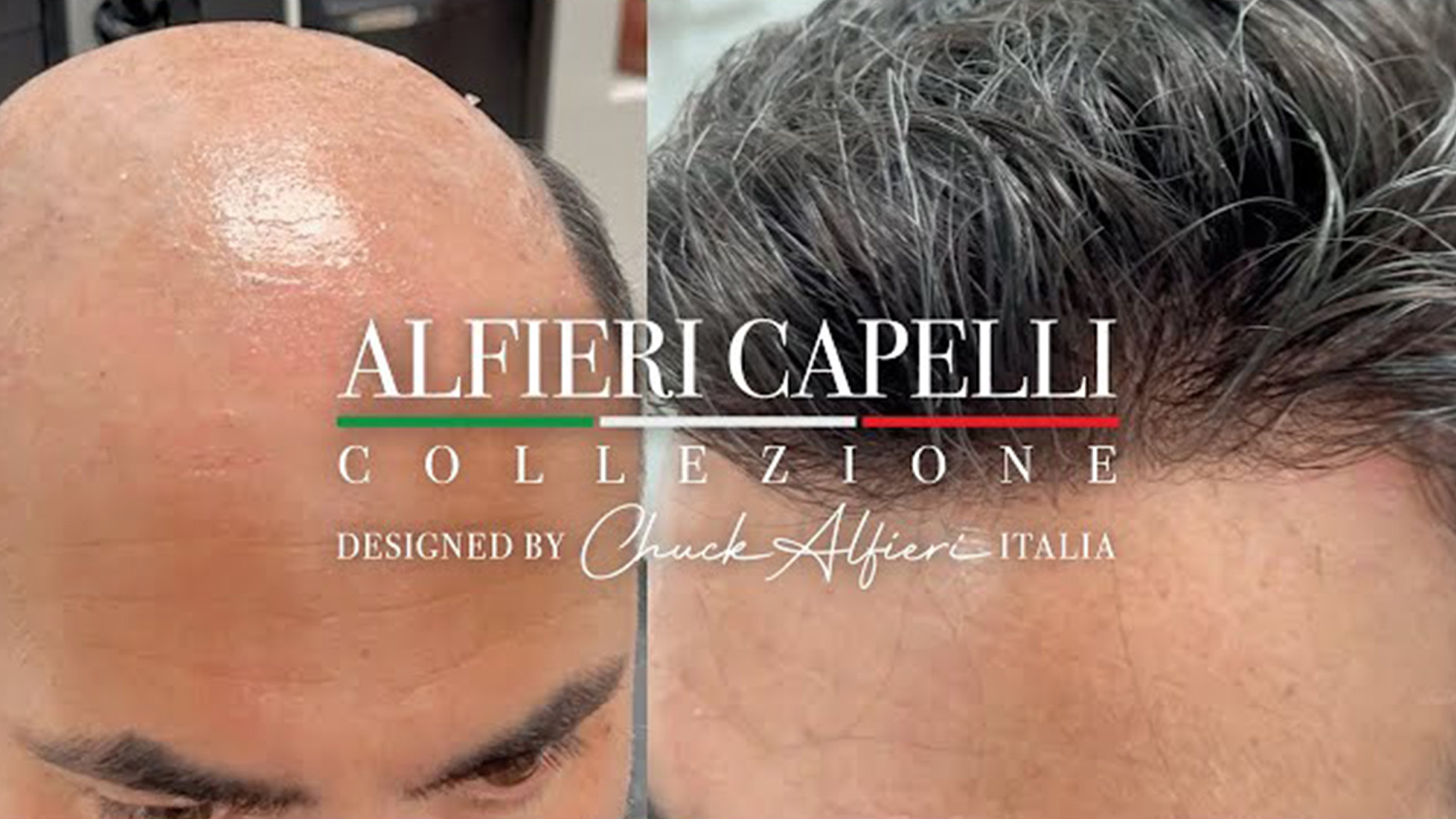 Before-and-after photo of a bald scalp on the left and a fuller hairstyle on the right, promoting Alfieri Capelli Collezione hair restoration.