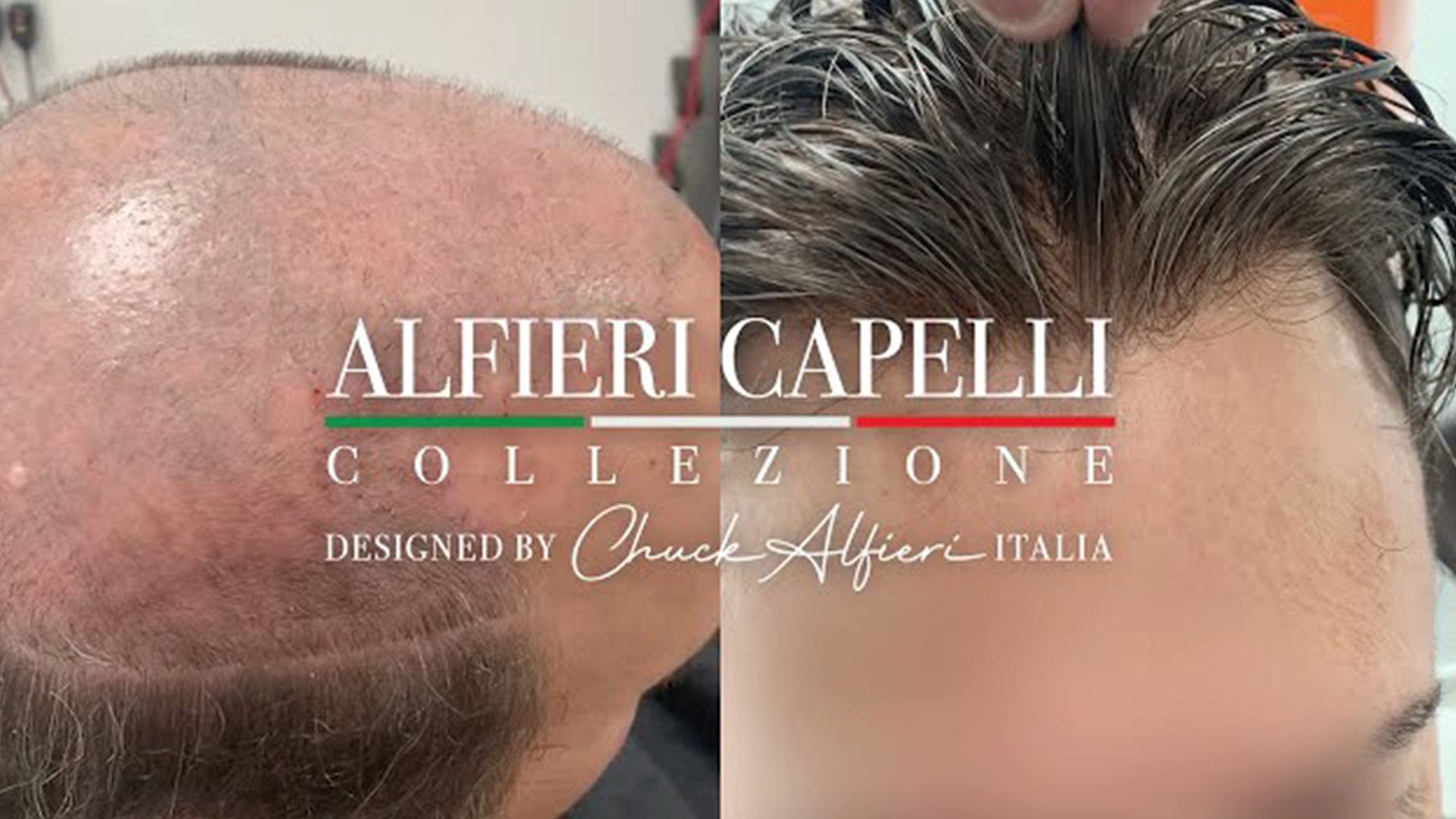 Side-by-side image showing a bald scalp on the left and a fuller hair look on the right, with the Alfieri Capelli Collezione logo overlay.