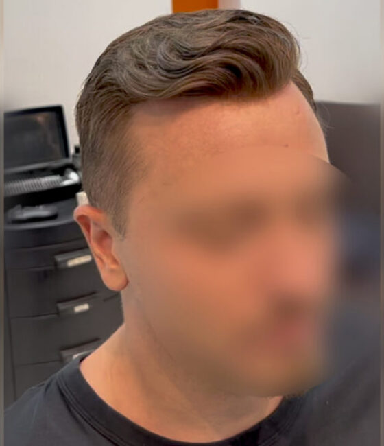 Close-up of a man with a slicked-back side-part hairstyle; face is blurred for privacy in a barbershop setting.