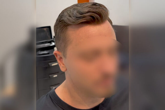 Close-up of a man with a slicked-back side-part hairstyle; face is blurred for privacy in a barbershop setting.
