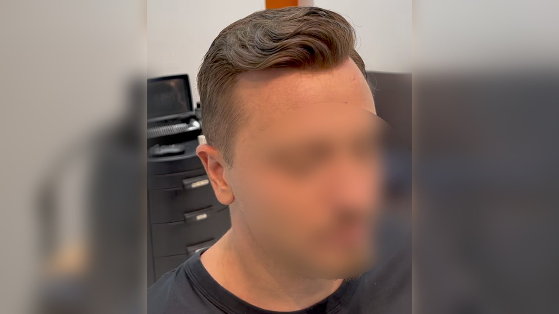 Close-up of a man with a slicked-back side-part hairstyle; face is blurred for privacy in a barbershop setting.